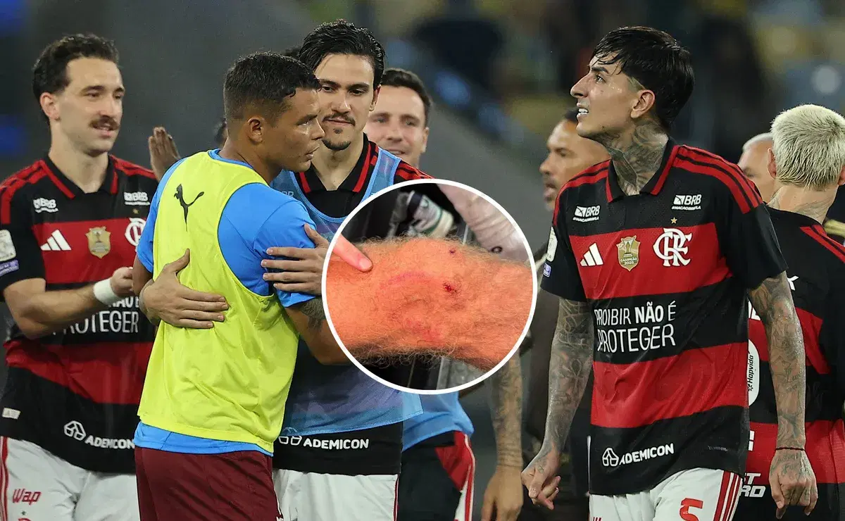 Fluminense acusa a Pulgar por 'juego desleal' en clásico
